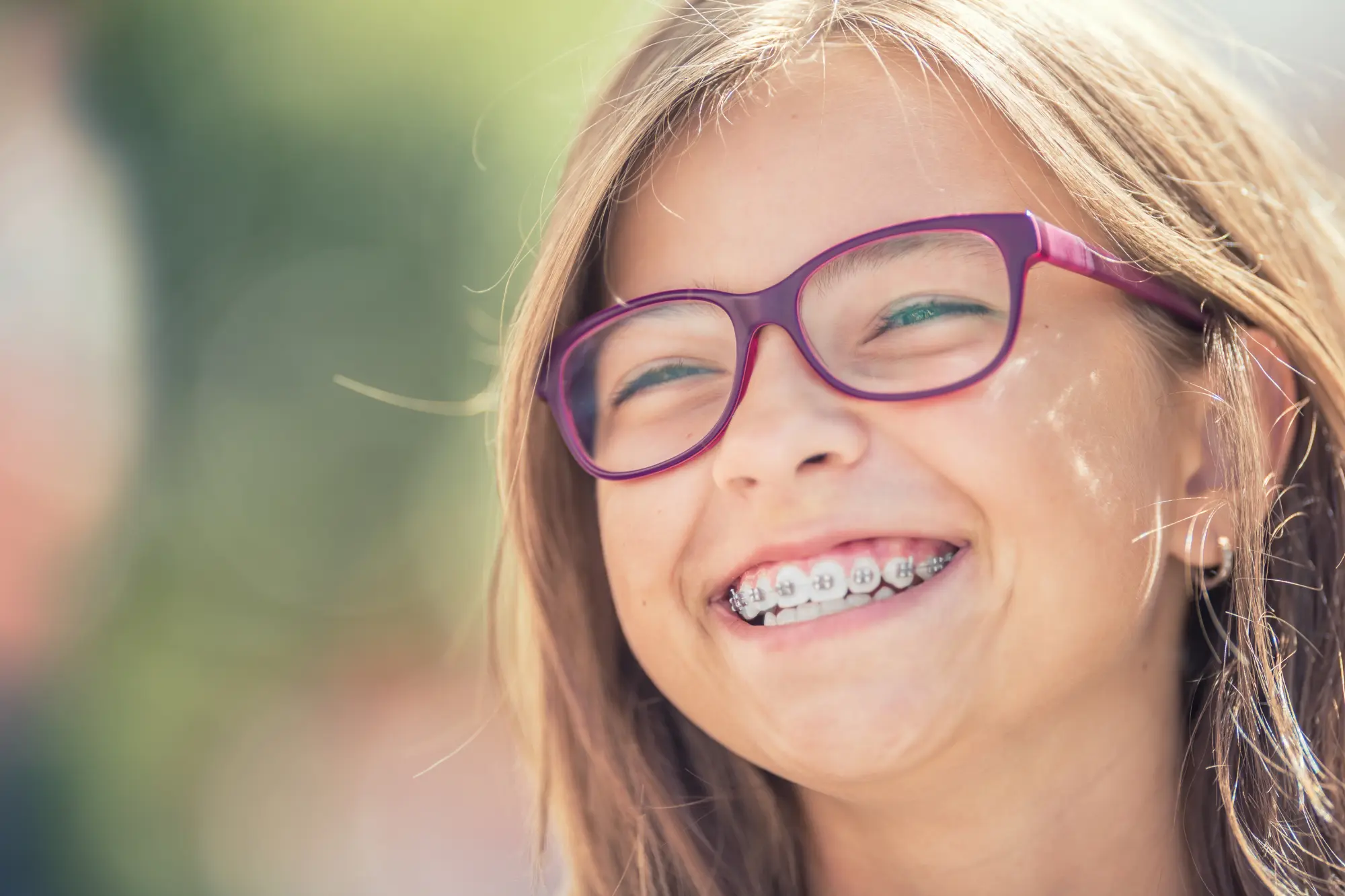braces near rexburg