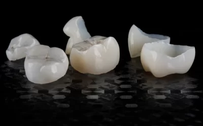 Do I Need a Dental Crown?