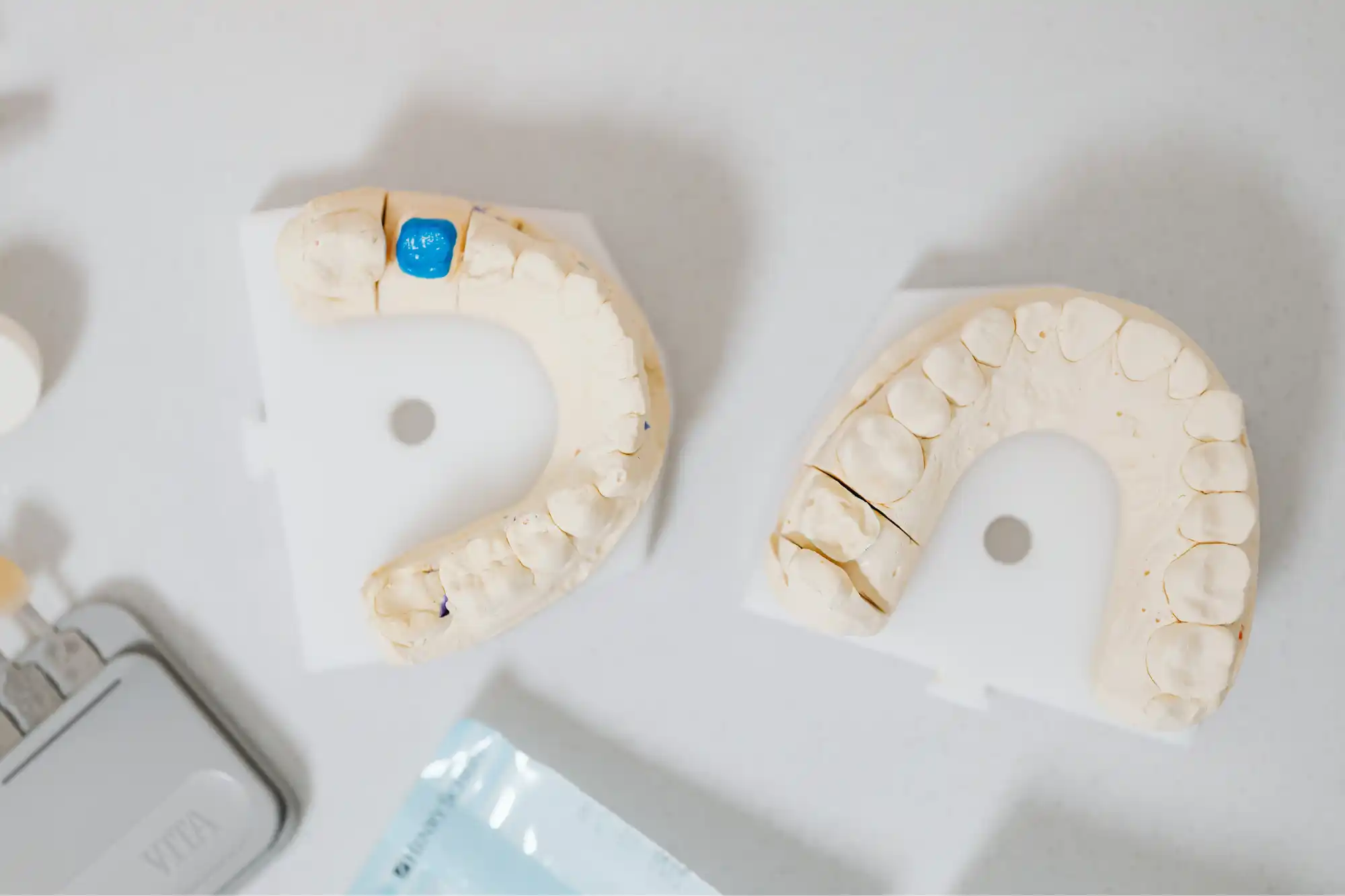 Molds or impressions for dental crowns rexburg ID