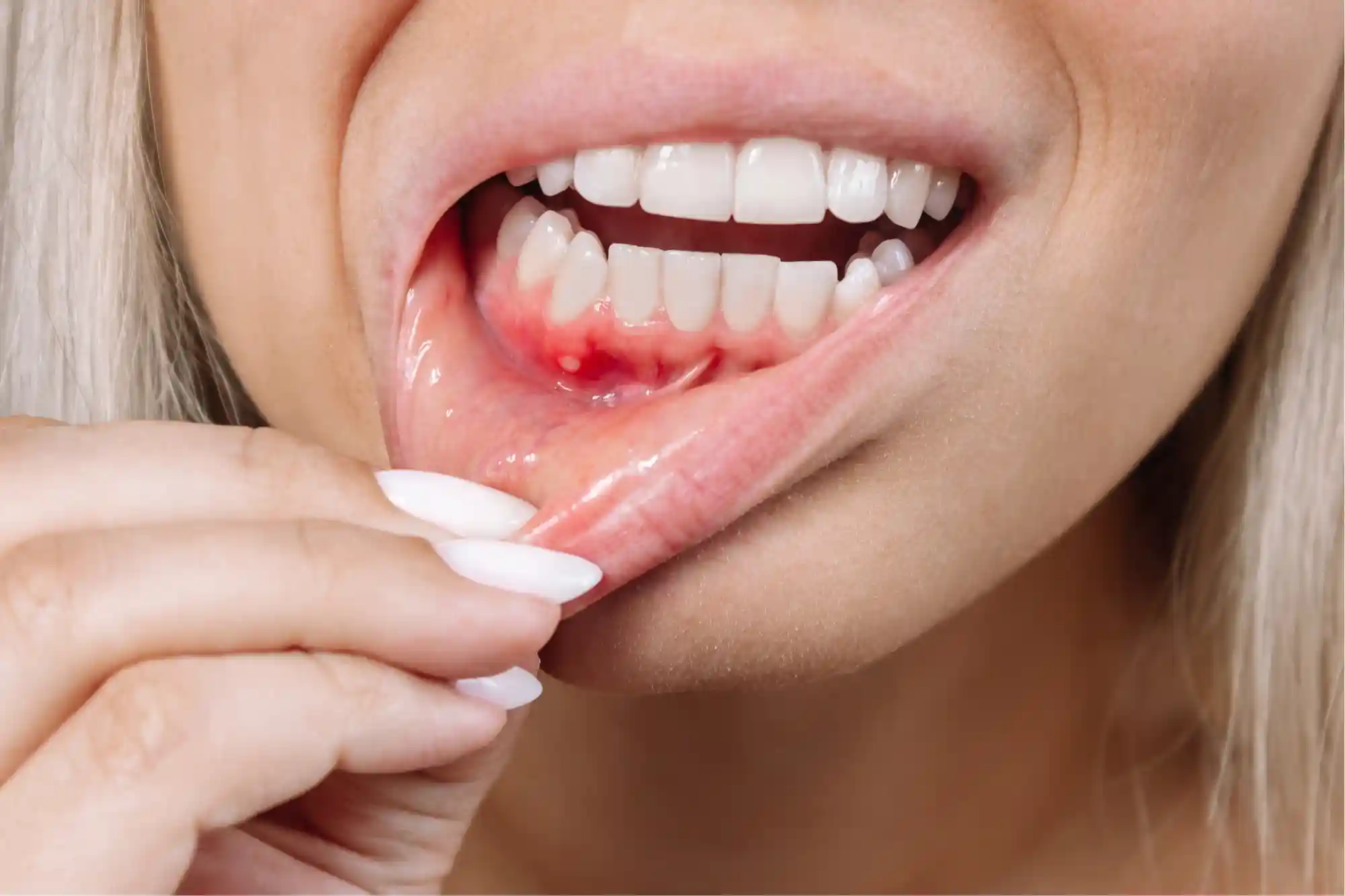 photo of bump on my gums