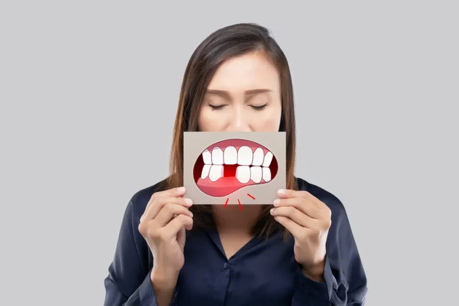 Dental Implant Procedure