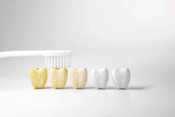 Teeth Cleaning – Family Dentist Rexburg